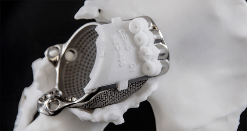 Brian McLaughlin comments on 3D Printing’s Important Role in the Future of Personalized Patient Care